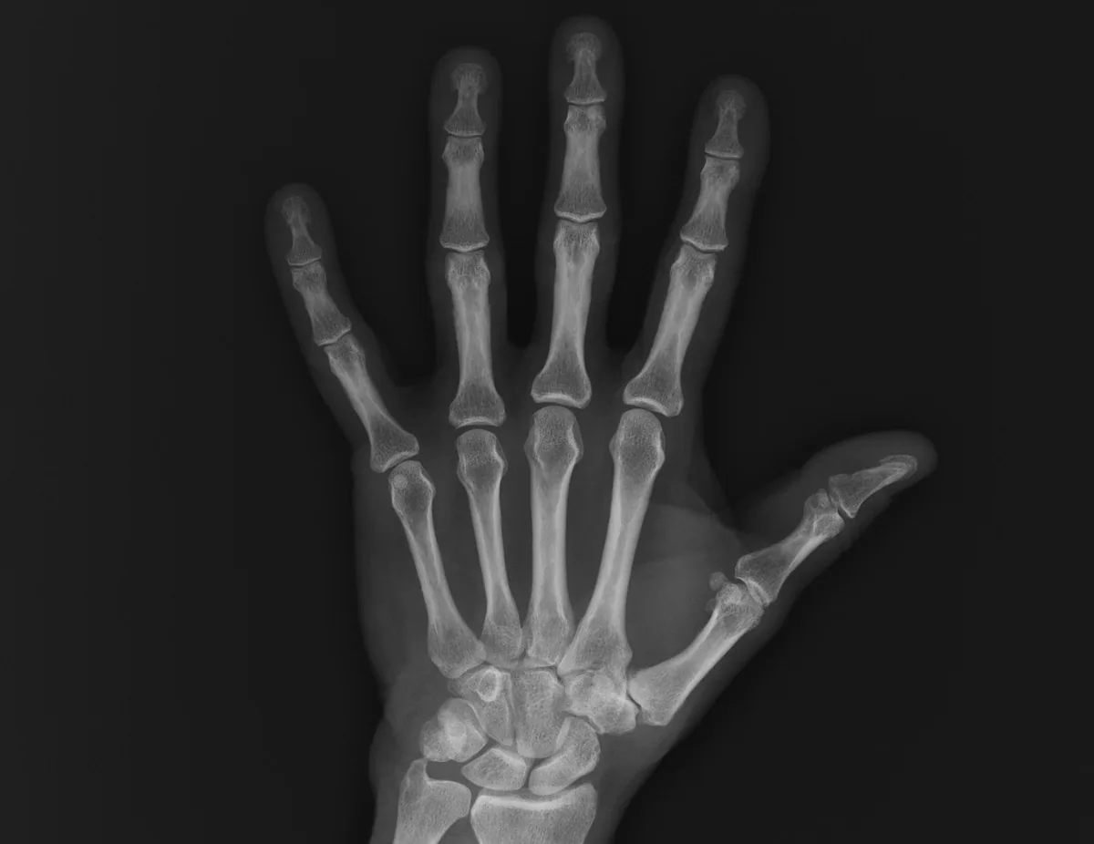 Patologie della mano