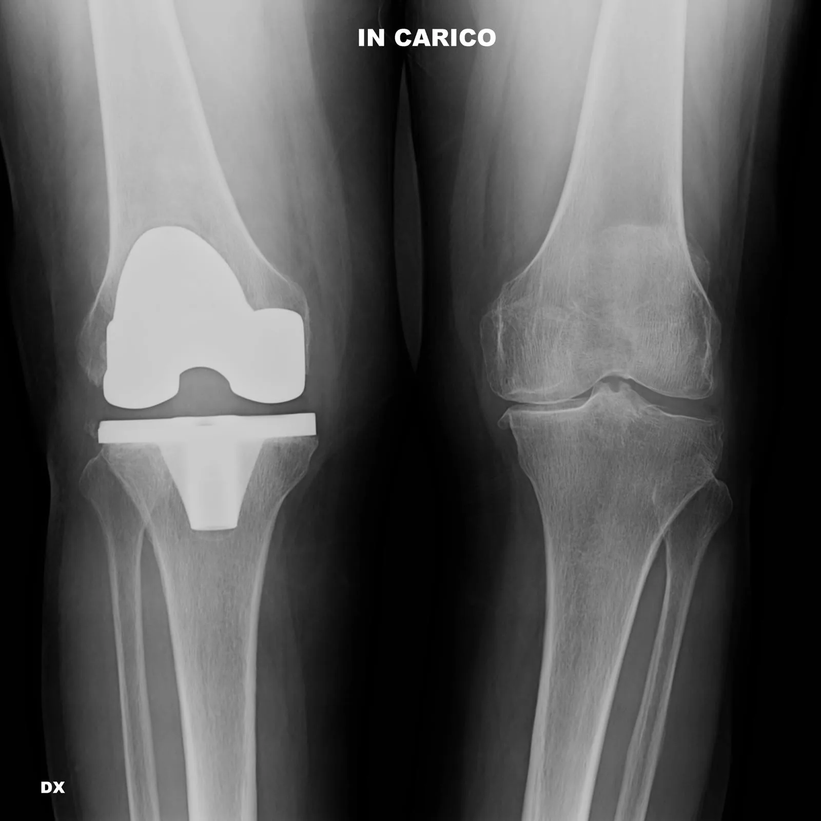 Chirurgia del ginocchio